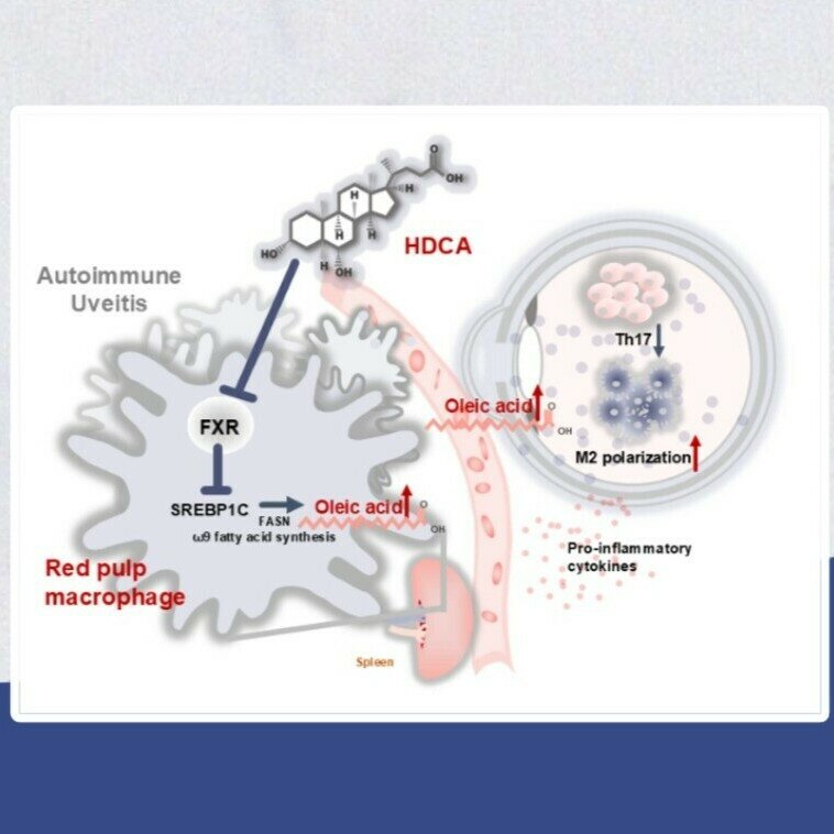 肠道胆汁酸调控“肠-脾-眼”免疫轴,创新自身免疫性葡萄膜炎防治