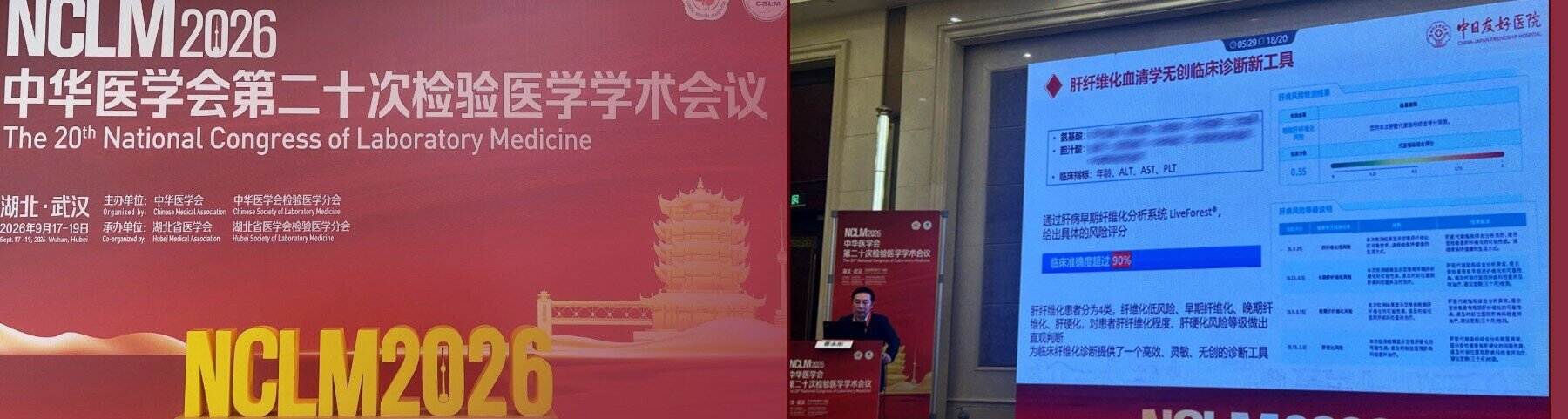 绘云生物肝纤检测方案再现中华医学会检验医学盛会