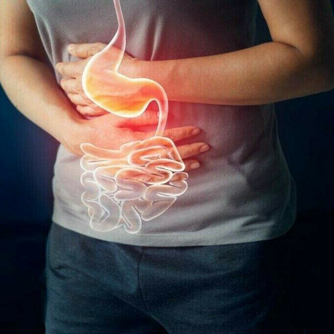 揭开胆汁反流触发胃癌的背后机制
